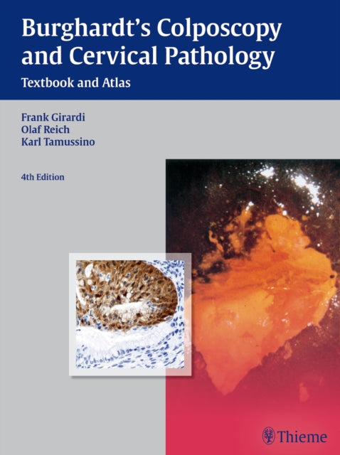 Book cover of: Burghardt's Colposcopy and Cervical Pathology. By: Erich Burghardt