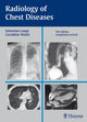Book cover of: Radiology of Chest Diseases. By: Sebastian Lange