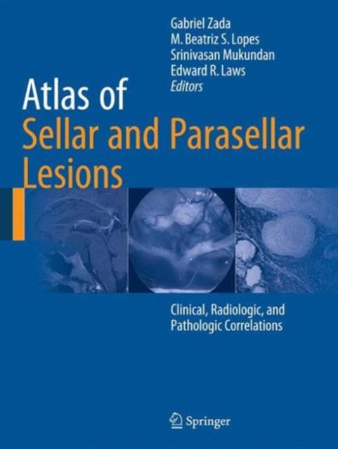 Book cover of: Atlas of Sellar and Parasellar Lesions. By: Gabriel Zada