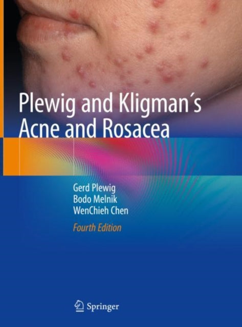 Book cover of: Plewig and Kligman´s Acne and Rosacea. By: Gerd Plewig