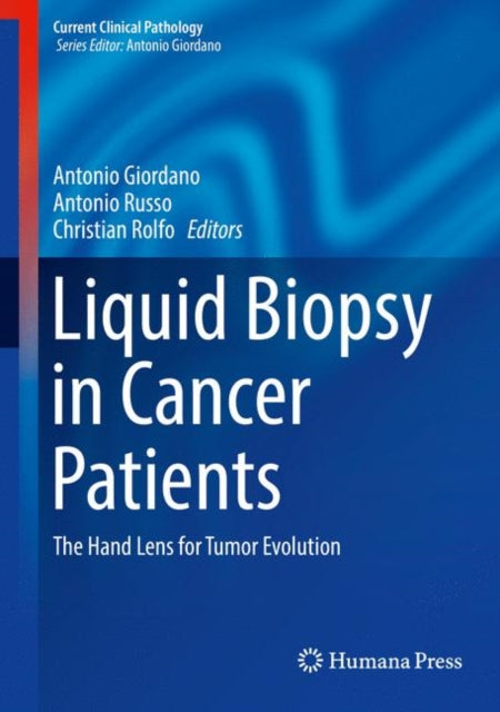 Book cover of: Liquid Biopsy in Cancer Patients. By: Antonio Russo