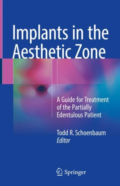 Book cover of: Implants in the Aesthetic Zone. By: Todd R. Schoenbaum
