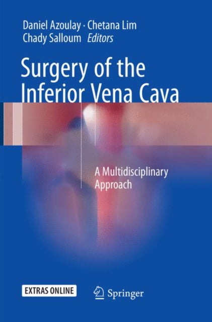 Book cover of: Surgery of the Inferior Vena Cava. By: Daniel Azoulay