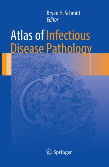 Book cover of: Atlas of Infectious Disease Pathology. By: Bryan H. Schmitt