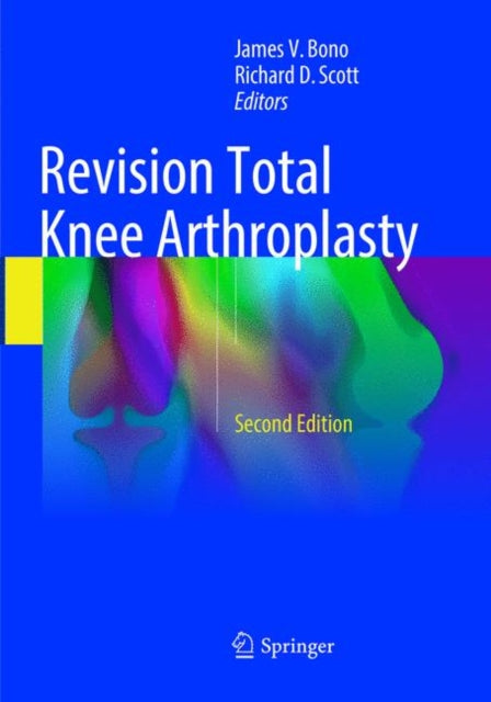 Book cover of: Revision Total Knee Arthroplasty. By: James V. Bono