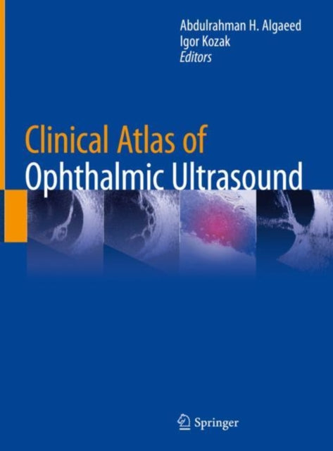 Book cover of: Clinical Atlas of Ophthalmic Ultrasound. By: Abdulrahman H. Algaeed