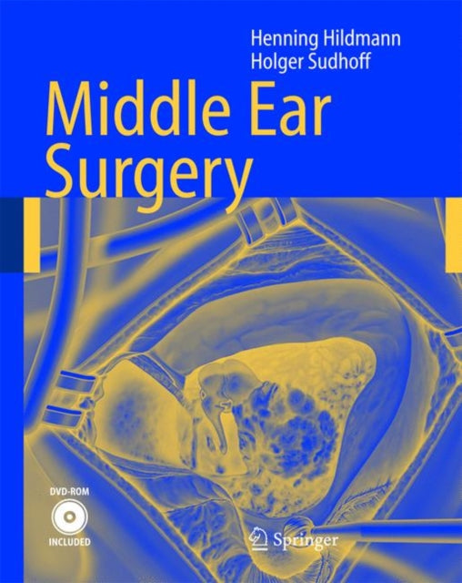 Book cover of: Middle Ear Surgery. By: Henning Hildmann