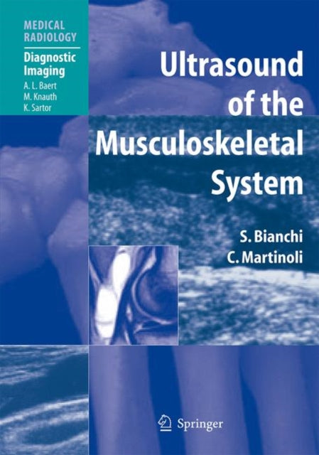 Book cover of: Ultrasound of the Musculoskeletal System. By: Stefano Bianchi