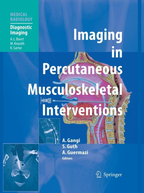 Book cover of: Imaging in Percutaneous Musculoskeletal Interventions