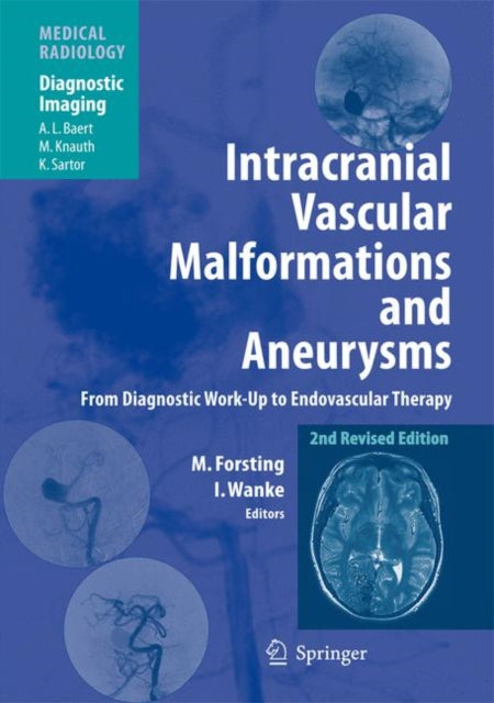 Book cover of: Intracranial Vascular Malformations and Aneurysms