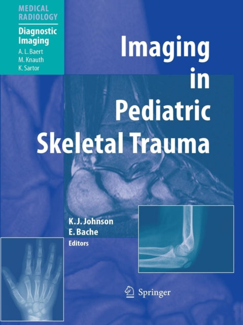 Book cover of: Imaging in Pediatric Skeletal Trauma. By: . Various