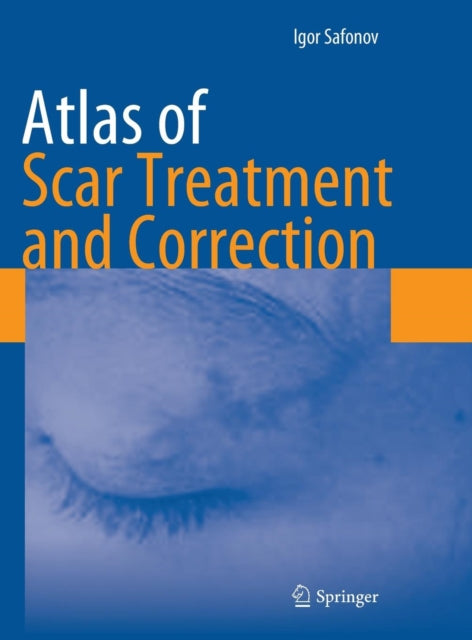 Book cover of: Atlas of Scar Treatment and Correction. By: Igor Safonov
