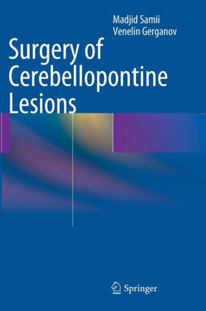 Surgery of Cerebellopontine Lesions