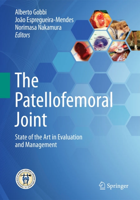 Book cover of: Patellofemoral Joint. By: Alberto Gobbi