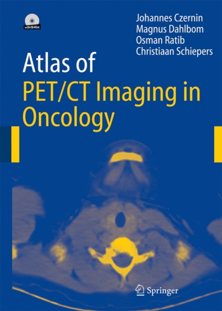 Book cover of: Atlas of PET/CT Imaging in Oncology. By: Johannes Czernin