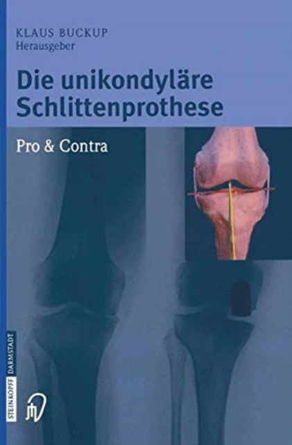 Book cover of: Die unikondylare Schlittenprothese Pro & Contra. By: Klaus Buckup