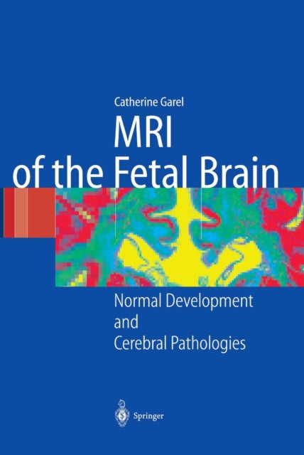 Book cover of: MRI of the Fetal Brain. By: C. Garel