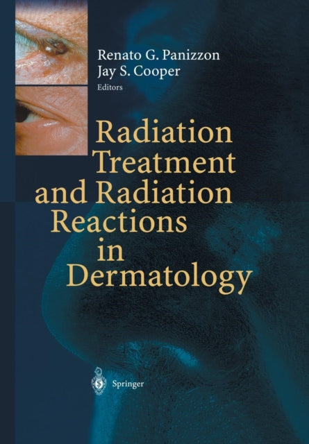 Book cover of: Radiation Treatment and Radiation Reactions in Dermatology. By: Renato G.Panizzon