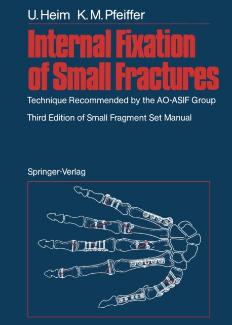 Book cover of: Internal Fixation of Small Fractures. By: Urs Heim