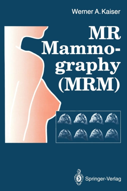Book cover of: MR Mammography (MRM). By: Werner A. Kaiser
