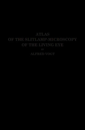 Atlas of the Slitlamp-Microscopy of the Living Eye