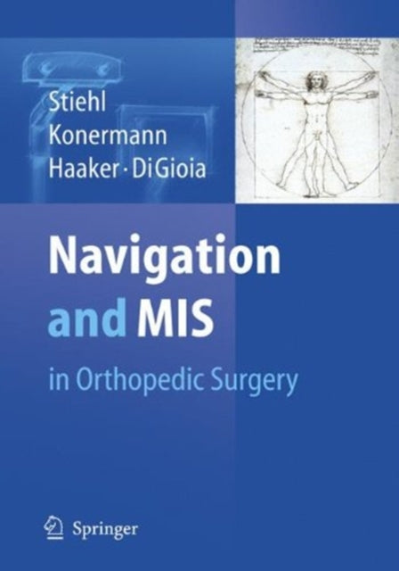 Book cover of: Navigation and MIS in Orthopedic Surgery. By: James B. Stiehl