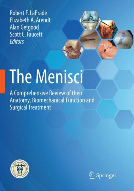 Book cover of: Menisci. By: Robert F. LaPrade