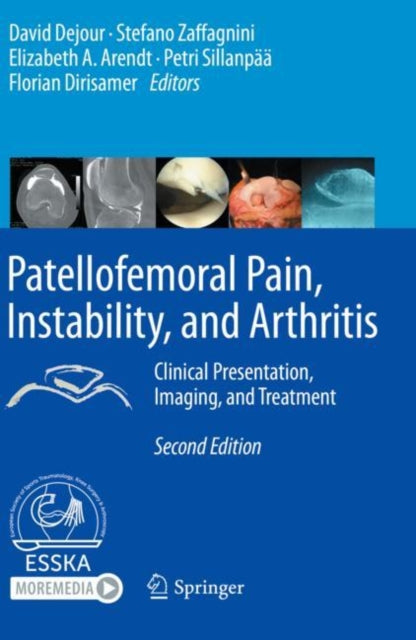 Book cover of: Patellofemoral Pain, Instability, and Arthritis. By: David Dejour