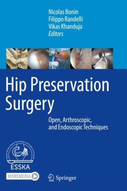 Book cover of: Hip Preservation Surgery. By: Nicolas Bonin