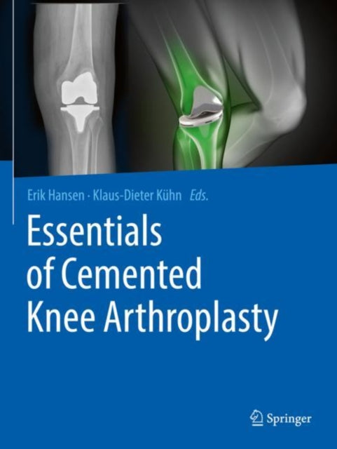 Book cover of: Essentials of Cemented Knee Arthroplasty. By: Erik Hansen