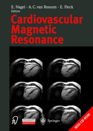 Cardiovascular Magnetic Resonance