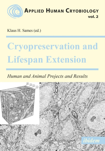 Book cover of: Cryopreservation and Lifespan Extension. By: Klaus H. Sames