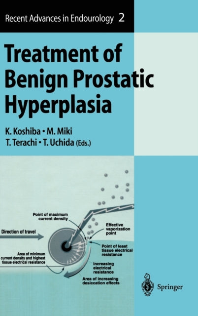 Book cover of: Treatment of Benign Prostatic Hyperplasia