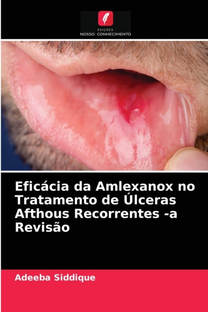 Book cover of: Eficacia da Amlexanox no Tratamento de Ulceras Afthous Recorrentes -a Revisao