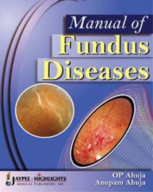 Book cover of: Manual of Fundus Diseases. By: OP Ahuja