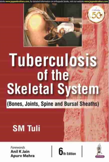 Book cover of: Tuberculosis of the Skeletal System. By: TULSI