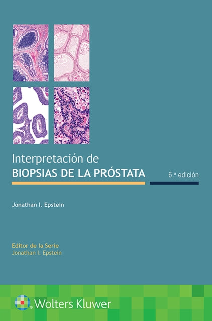 Book cover of: Interpretacion de biopsias de la prostata. By: Jonathan I. Epstein