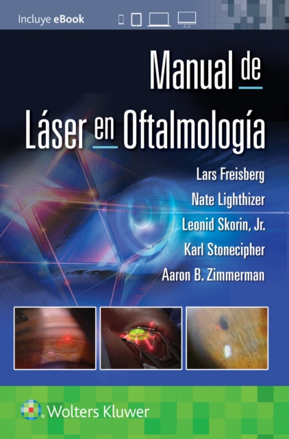 Book cover of: Manual de laser en oftalmologia. By: LIGHTHIZER