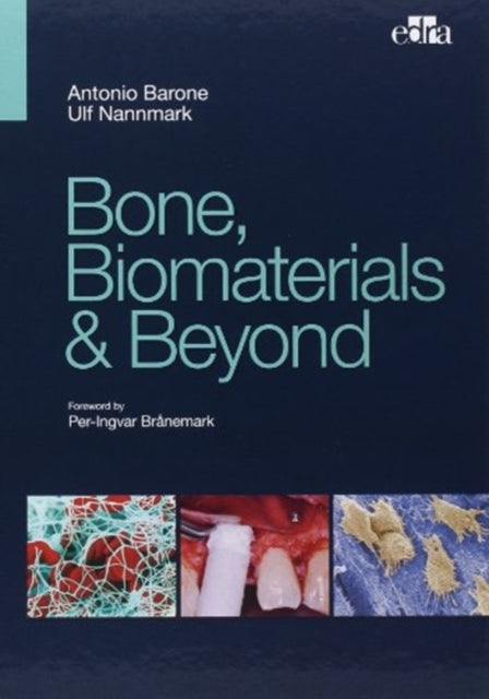 Book cover of: Bone, Biomaterials & Beyond. By: Antonio Barone