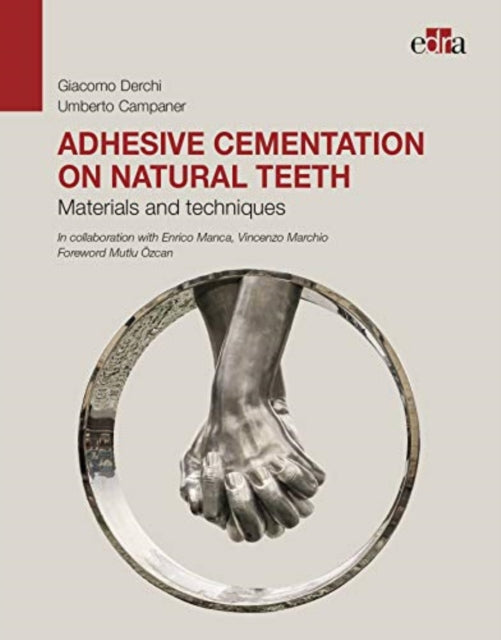 Book cover of: Adhesive cementation on natural teeth - Materials and techniques