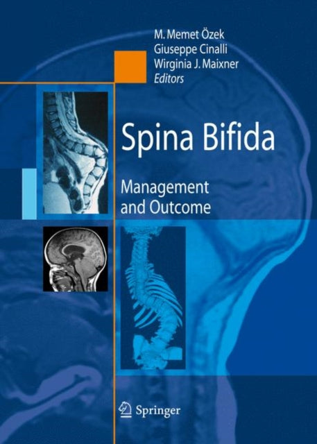 Book cover of: Spina Bifida