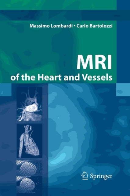 Book cover of: MRI of the Heart and Vessels. By: M. Walker