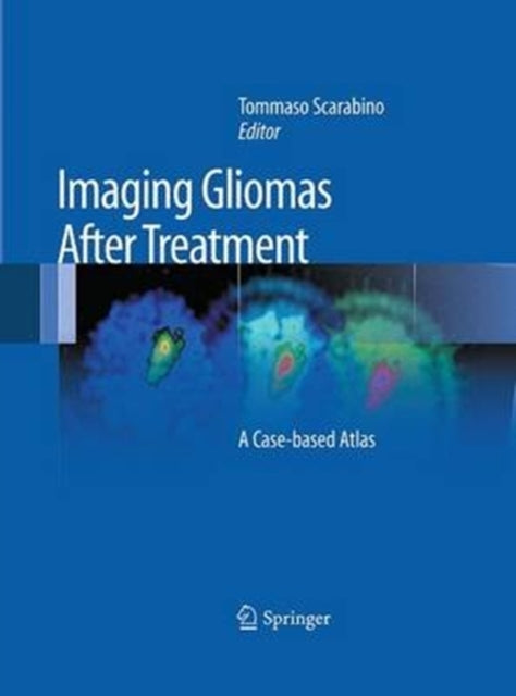 Book cover of: Imaging Gliomas After Treatment. By: Tommaso Scarabino