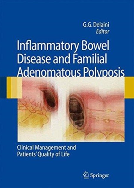 Book cover of: Inflammatory Bowel Disease and Familial Adenomatous Polyposis. By: Gian Gaetano Delaini