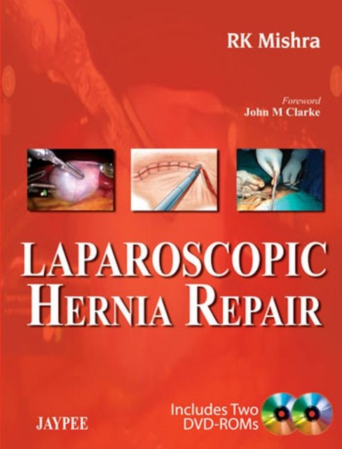 Book cover of: Laparoscopic Hernia Repair. By: R. K. Mishra