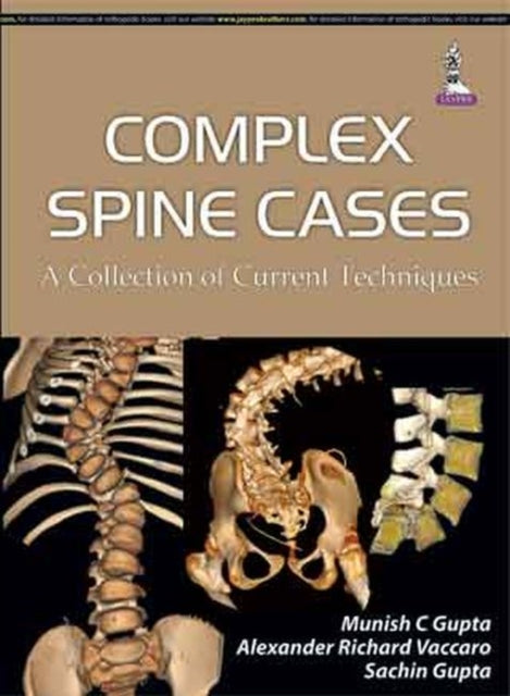 Book cover of: Complex Spine Cases: A Collection of Current Techniques. By: Sachin Gupta