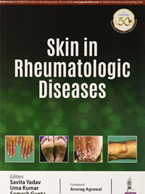 Book cover of: Skin in Rheumatologic Diseases. By: Kumar SAVITA