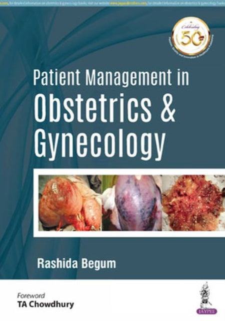 Book cover of: Patient Management in Obstetrics & Gynecology. By: Rashida Begum