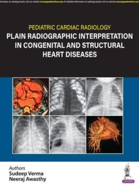 Book cover of: Pediatric Cardiac Radiology. By: Sudeep Verma