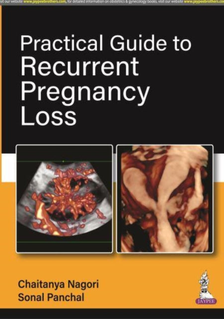 Book cover of: Practical Guide to Recurrent Pregnancy Loss. By: Chaitanya Nagori